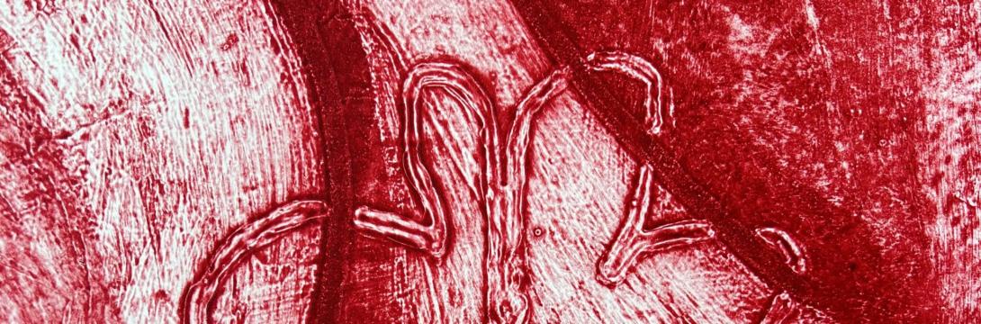  Sonje Vulpes: Plasti